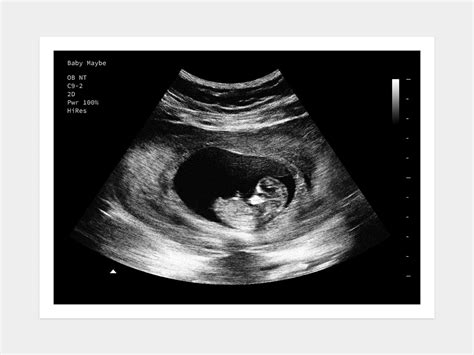 Trimmed as a connected Strip of 3 Photos. . Fake baby ultrasound free